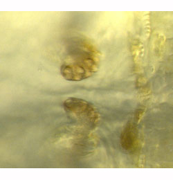 Agromyza alnivora larva,  anterior spiracles,  dorsal
