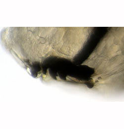 Agromyza anthracina,  larva,  mandibles,  lateral