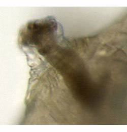 Agromyza ferruginosa larva,  anterior spiracle,  lateral