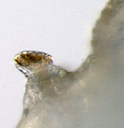 Agromyza igniceps : Anterior spiracle