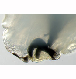 Agromyza igniceps larva,  mandible,  lateral