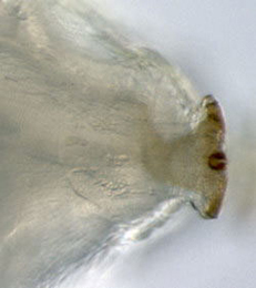 Agromyza igniceps larva,  posterior spiracle,  dorsal