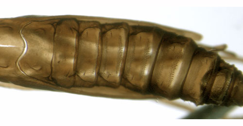Cameraria ohridella larva,  abdomen
