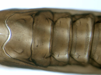 Cameraria ohridella larva,  thorax and abdomen