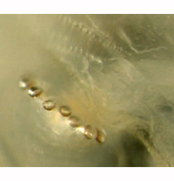 Pegomya hyoscyami larva,  anterior spiracle