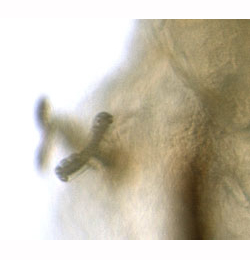 Phytomyza astrantiae larva,  anterior spiracle,  lateral