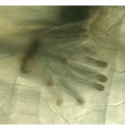 Scaptomyza flava larva,  anterior spiracle,  dorsal