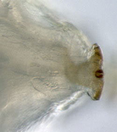 Agromyza igniceps [Diptera: Agromyzidae]