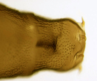 Phyllonorycter anderidae pupa,  dorsal